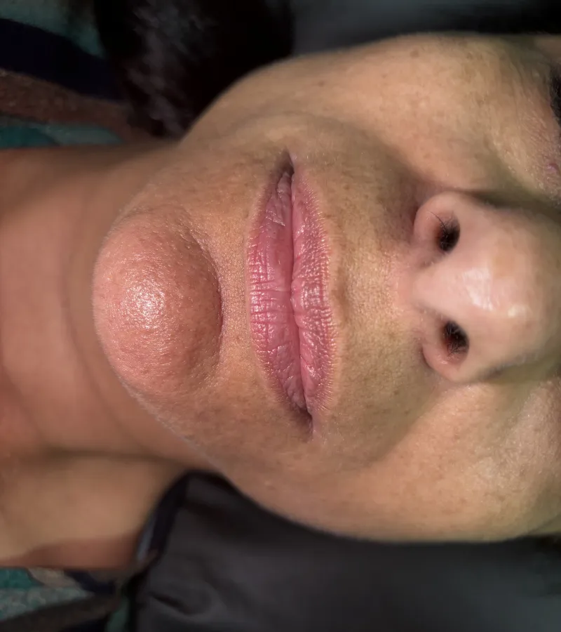 Resultado Sofia Simões