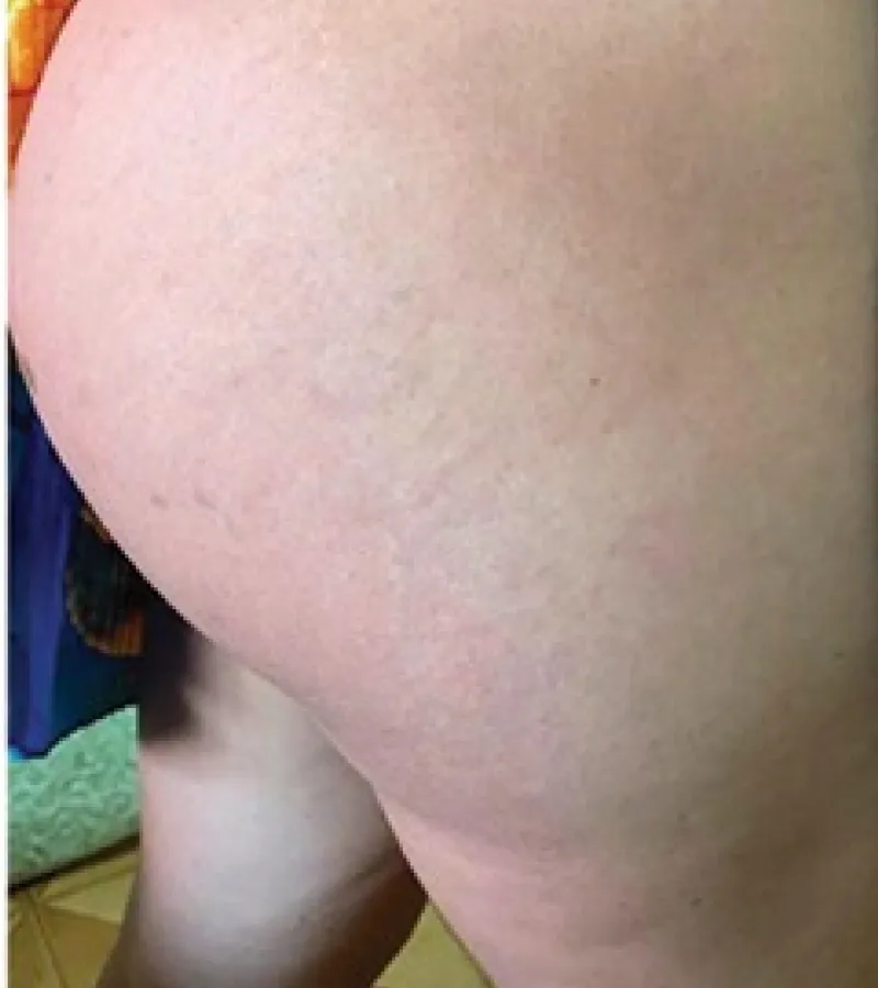 Resultado Sofia Simões